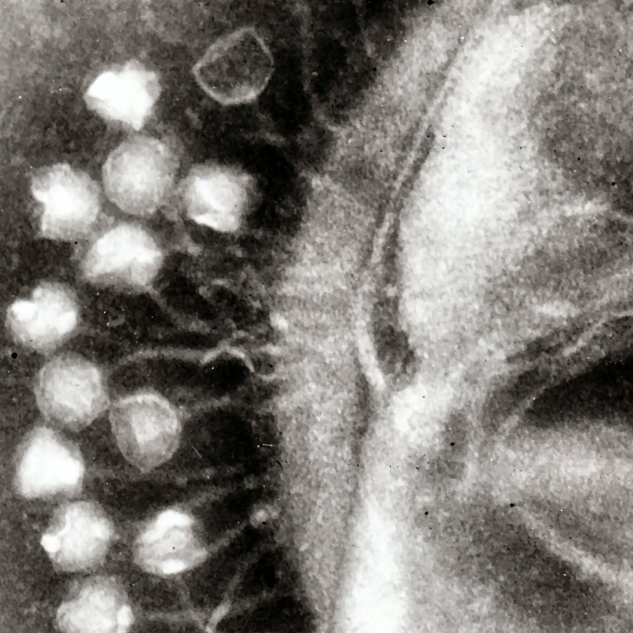 Obtienen los primeros resultados clínicos de virus que destruyen bacterias multirresistentes