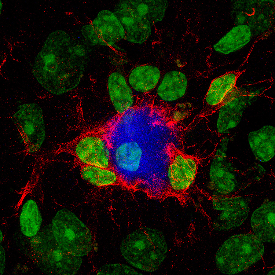 Una molécula experimental logra «reprogramar» las defensas del cerebro frente al alzhéimer