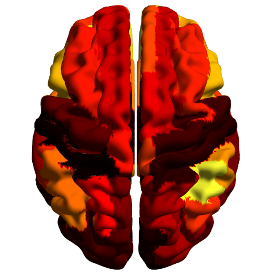 Un estudio revela la arquitectura dinámica del cerebro utilizando técnicas avanzadas de resonancia magnética