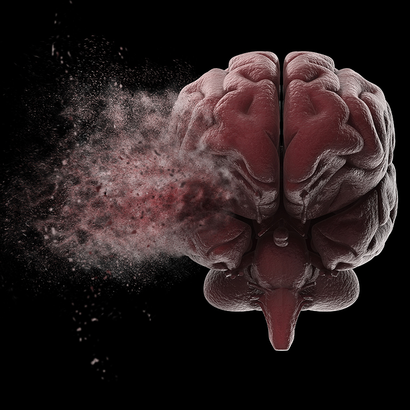 Identifican alteraciones en una proteína implicada en el desarrollo de Alzheimer