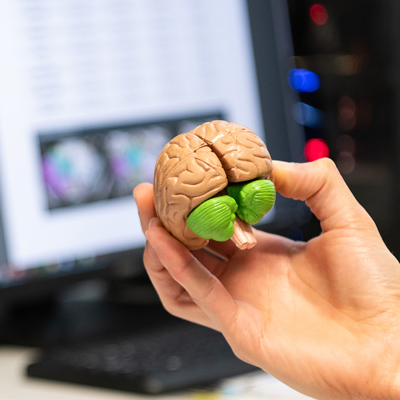 Desarrollan el software más avanzado del mundo para estudiar el cerebelo