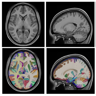 HoliAtlas, uno de los atlas del cerebro más detallados del mundo
