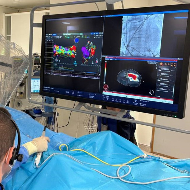 Primera tecnología de mapeo de corazón completo que permite obtener una visión global de las arritmias cardiacas en un solo latido