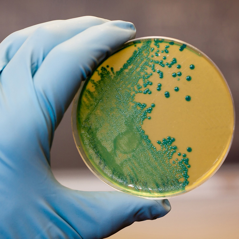 Patentan un nuevo método más eficaz, sostenible y seguro para combatir la listeria