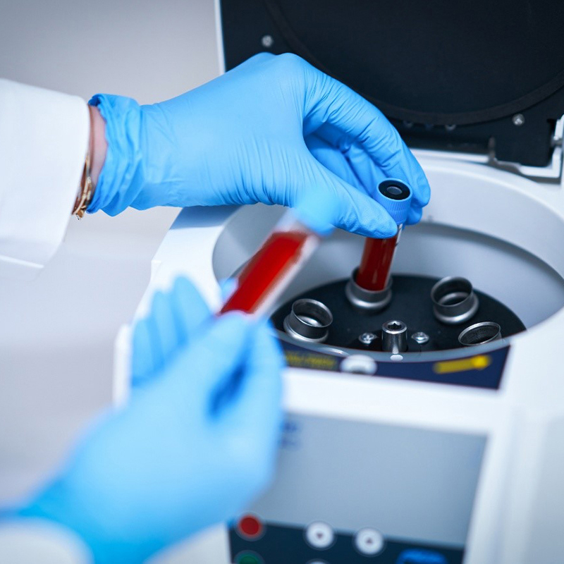 Un análisis genético de una muestra de sangre podría detectar el párkinson antes de los primeros síntomas